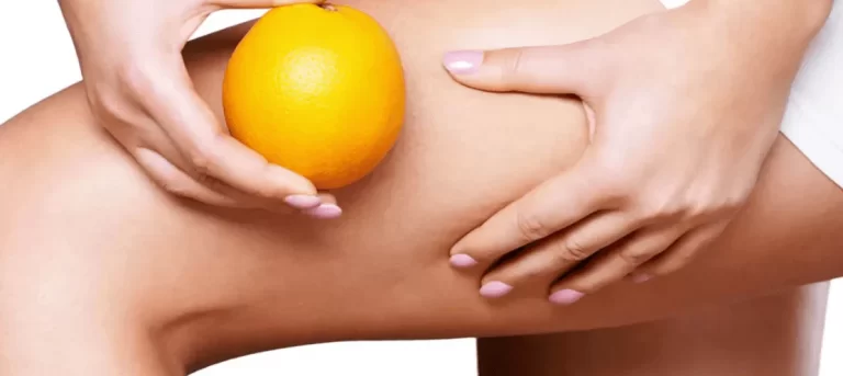 cellulite come combatterla rimedi anticellulite efficaci